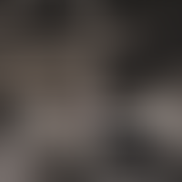 Подземный паркинг и кладовые